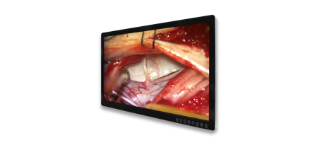 Чому монітори FSN є першим вибором для багатьох